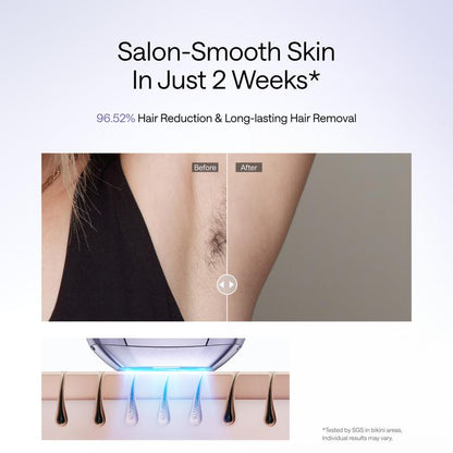 SilkPulse Pro